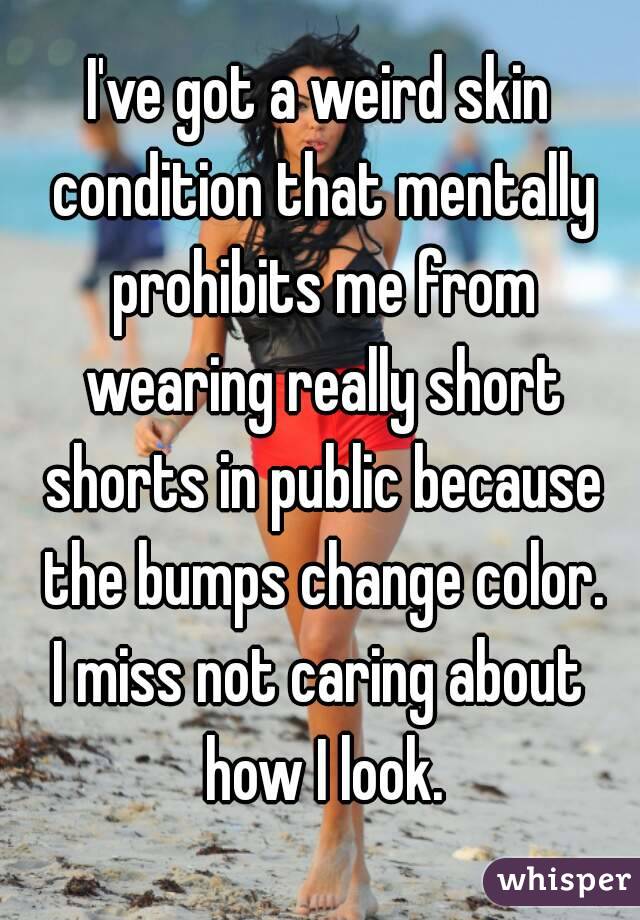 I've got a weird skin condition that mentally prohibits me from wearing really short shorts in public because the bumps change color.
I miss not caring about how I look.
