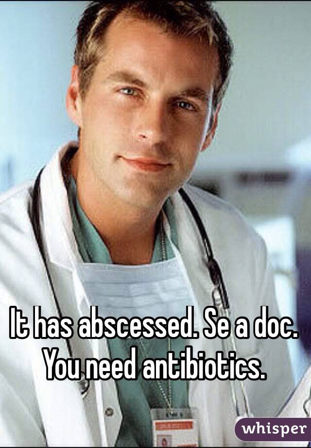 It has abscessed. Se a doc. You need antibiotics. 

