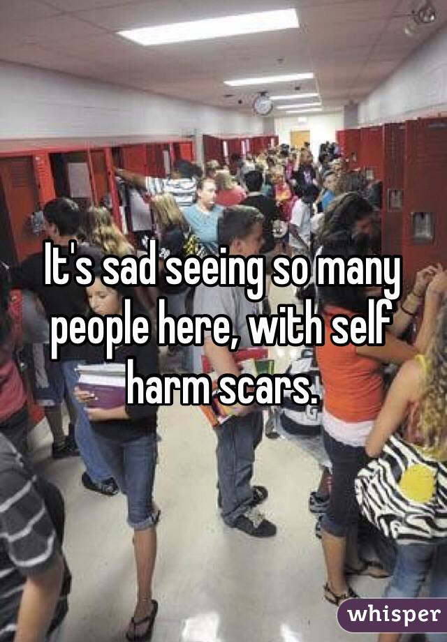 It's sad seeing so many people here, with self harm scars.
