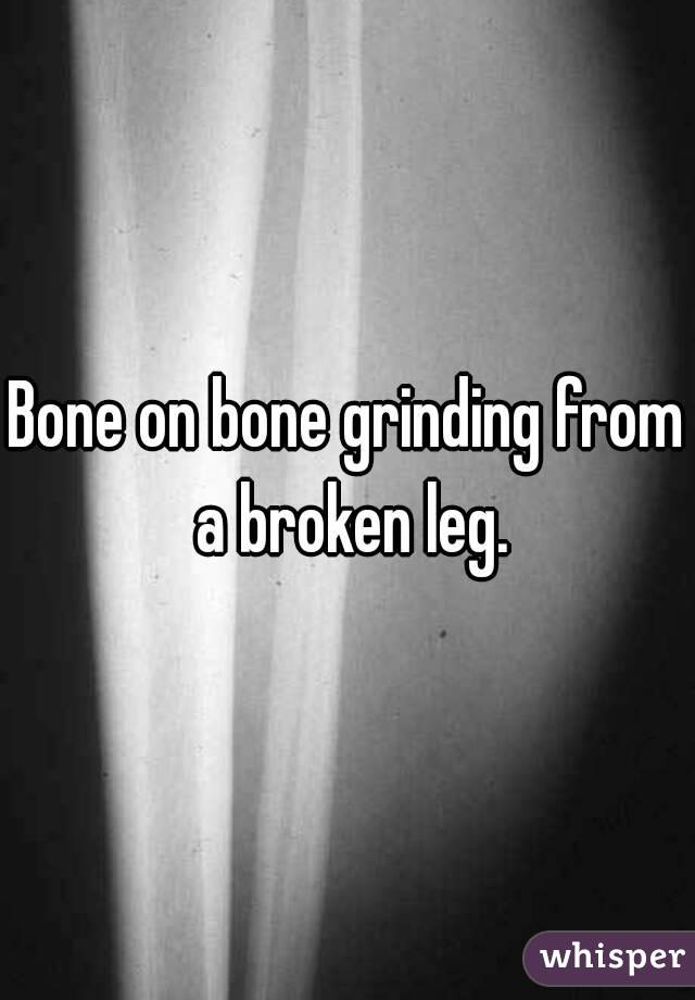 Bone on bone grinding from a broken leg.