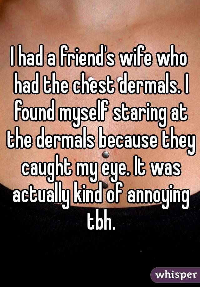 I had a friend's wife who had the chest dermals. I found myself staring at the dermals because they caught my eye. It was actually kind of annoying tbh.