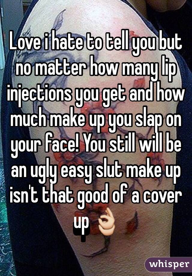 Love i hate to tell you but no matter how many lip injections you get and how much make up you slap on your face! You still will be an ugly easy slut make up isn't that good of a cover up 👌