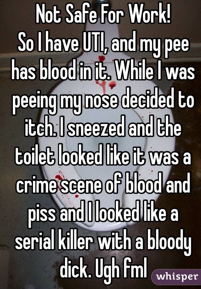 Not Safe For Work!
So I have UTI, and my pee has blood in it. While I was peeing my nose decided to itch. I sneezed and the toilet looked like it was a crime scene of blood and piss and I looked like a serial killer with a bloody dick. Ugh fml