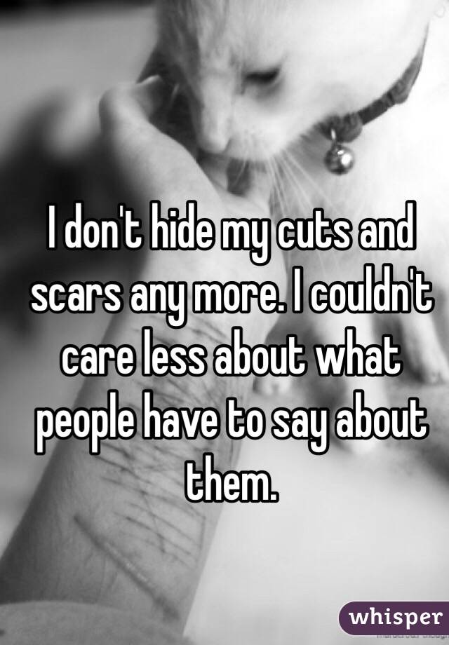 I don't hide my cuts and scars any more. I couldn't care less about what people have to say about them. 