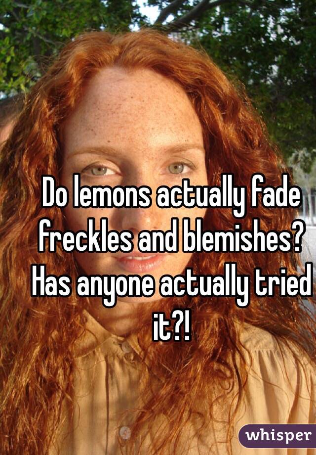 Do lemons actually fade freckles and blemishes? Has anyone actually tried it?!