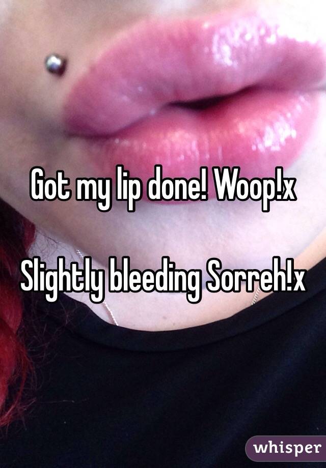 Got my lip done! Woop!x

Slightly bleeding Sorreh!x