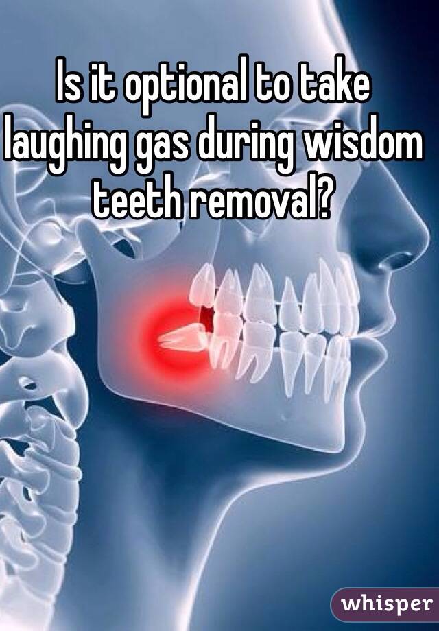 Is it optional to take laughing gas during wisdom teeth removal?