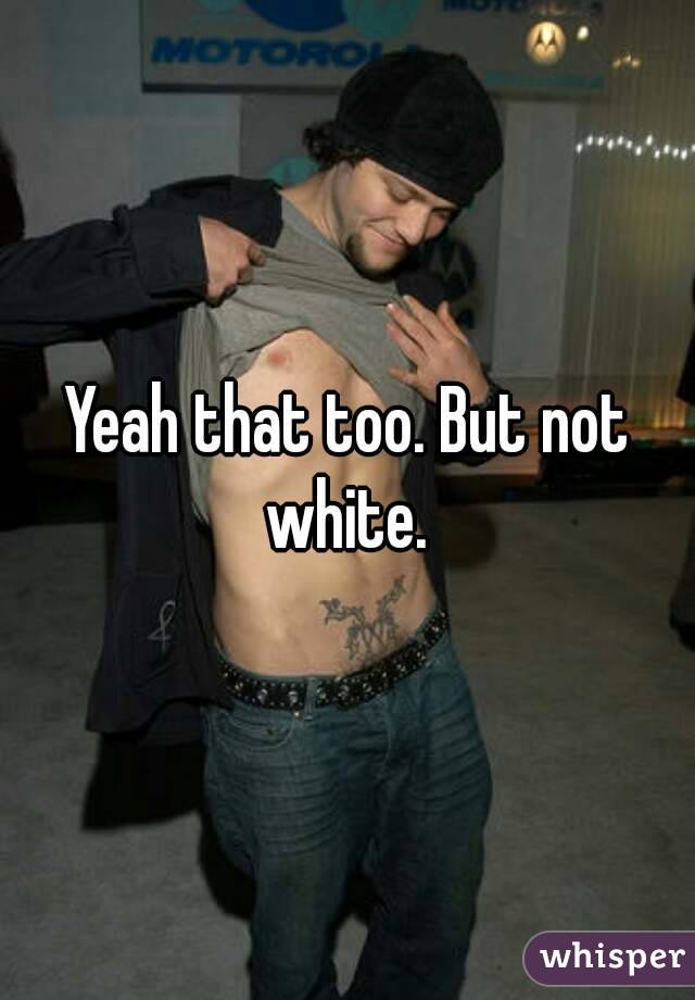 Yeah that too. But not white. 