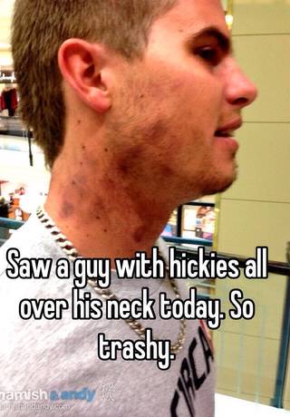 boys with hickies