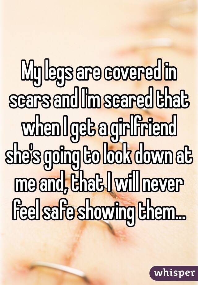 My legs are covered in scars and I'm scared that when I get a girlfriend she's going to look down at me and, that I will never feel safe showing them…
