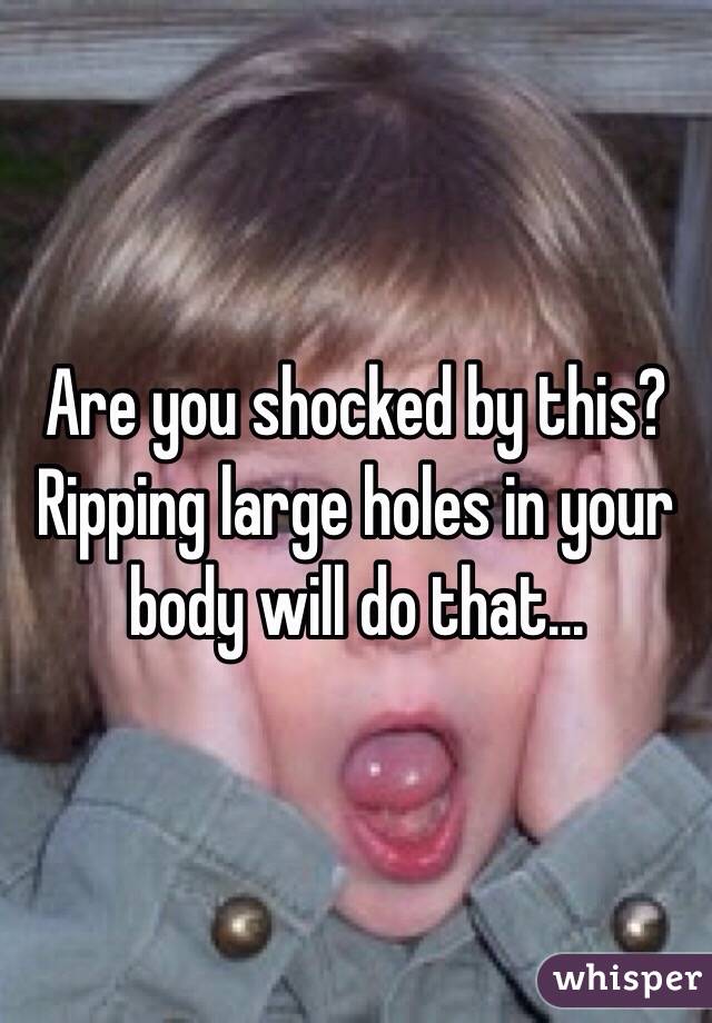 Are you shocked by this? Ripping large holes in your body will do that...