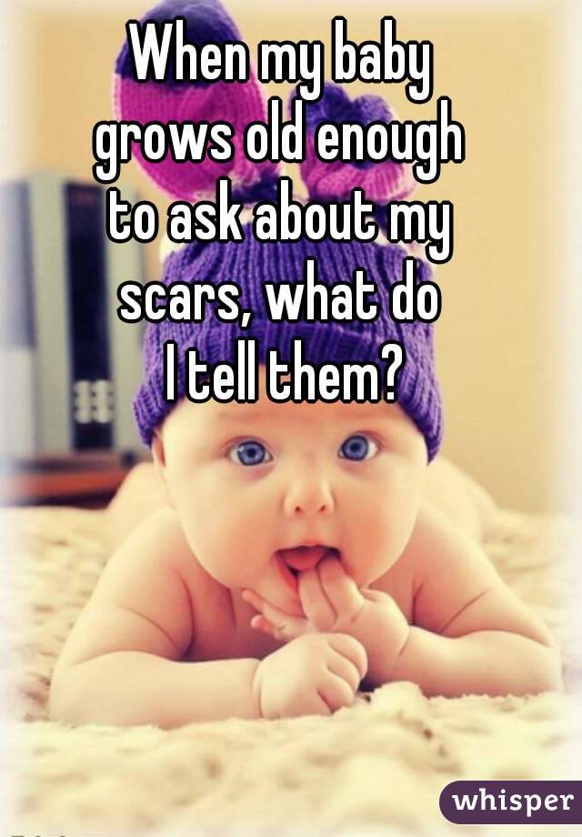 When my baby
grows old enough
to ask about my
scars, what do
 I tell them?
