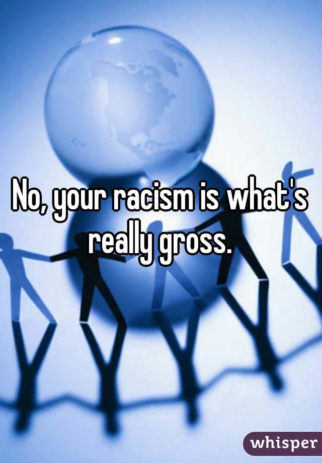No, your racism is what's really gross. 