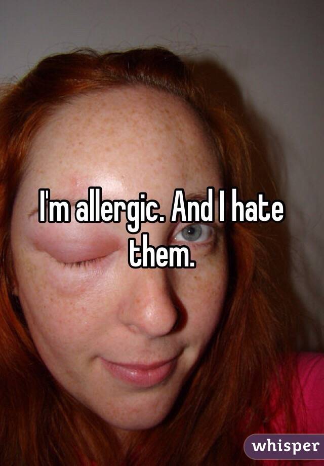 I'm allergic. And I hate them.