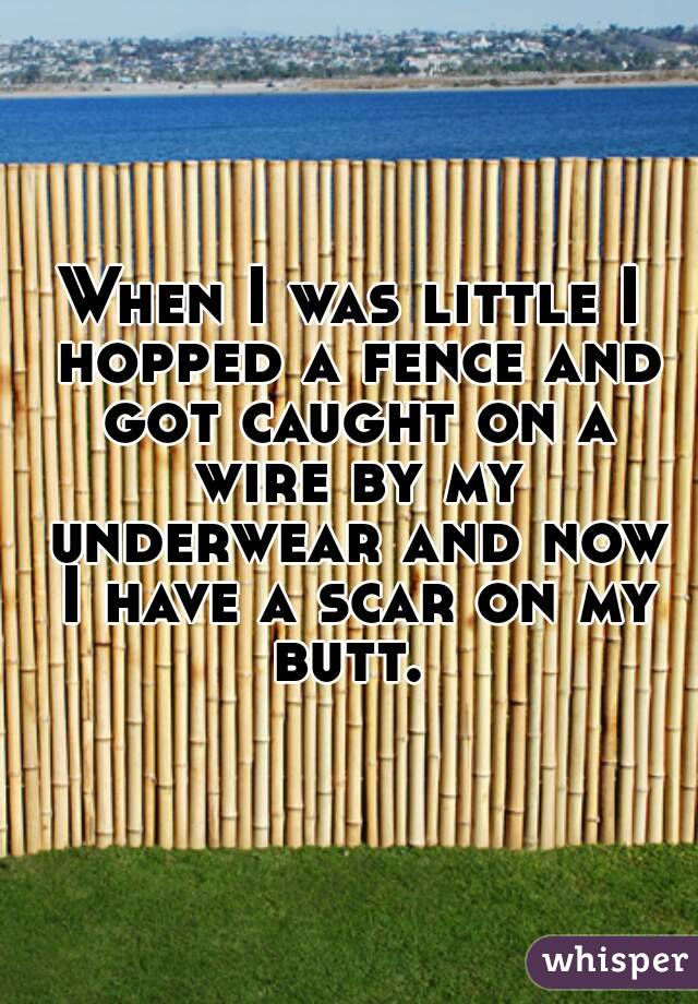 When I was little I hopped a fence and got caught on a wire by my underwear and now I have a scar on my butt. 