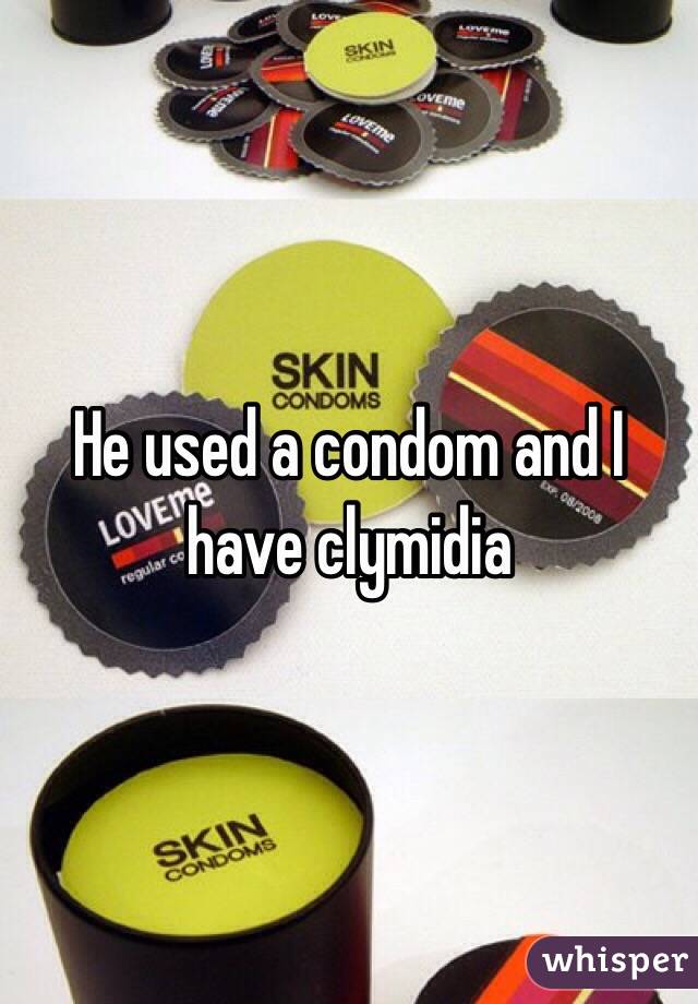 He used a condom and I have clymidia 