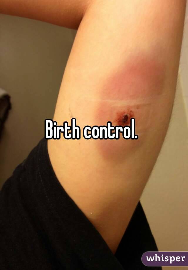 Birth control. 