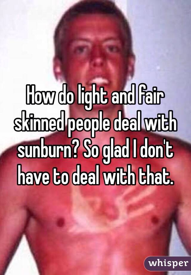 How do light and fair skinned people deal with sunburn? So glad I don't have to deal with that.
