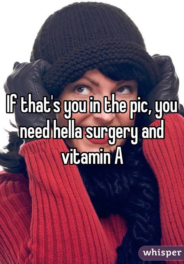 If that's you in the pic, you need hella surgery and vitamin A