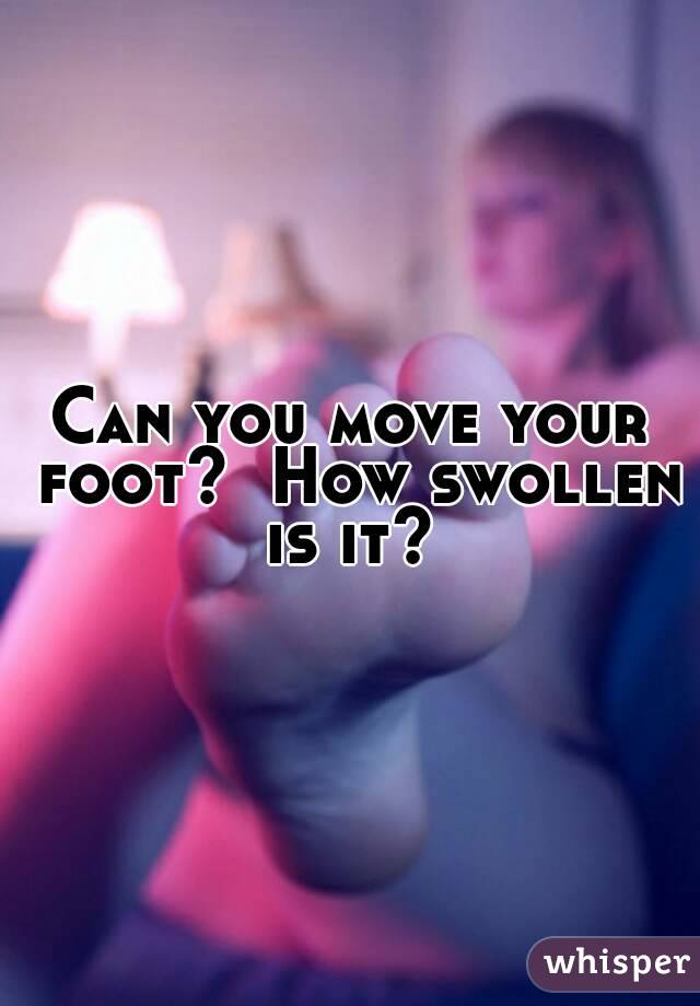 Can you move your foot?  How swollen is it? 