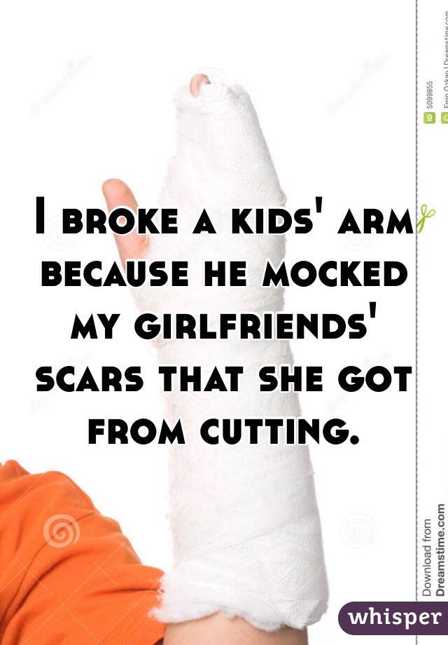 I broke a kids' arm because he mocked my girlfriends' scars that she got from cutting.