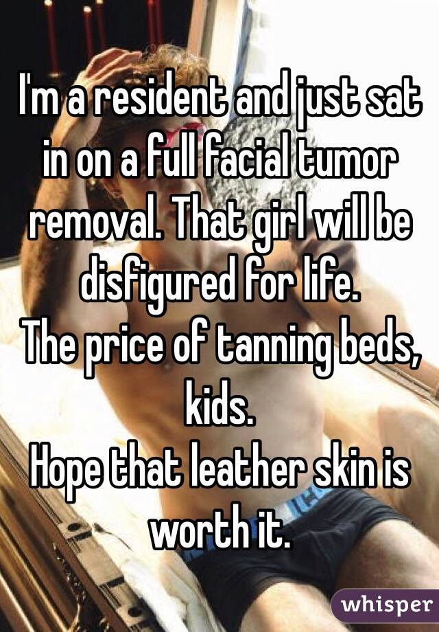 I'm a resident and just sat in on a full facial tumor removal. That girl will be disfigured for life.
The price of tanning beds, kids. 
Hope that leather skin is worth it.