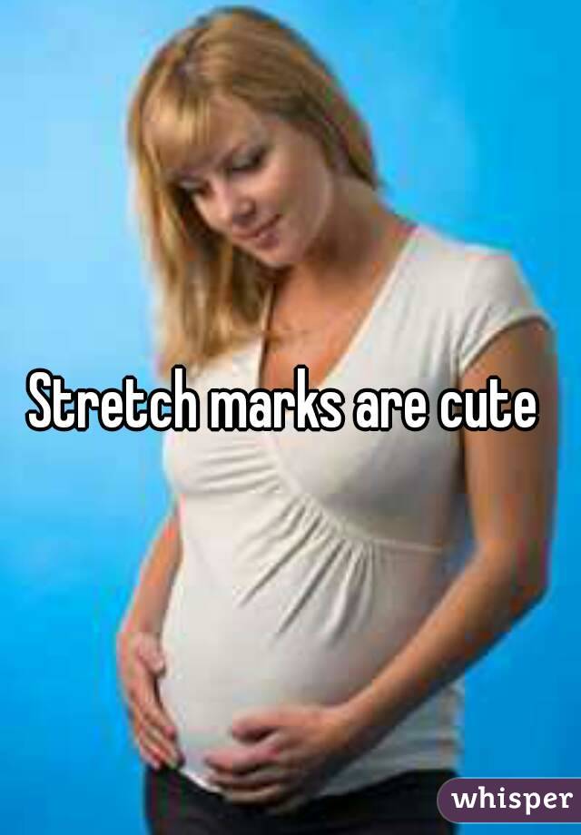 Stretch marks are cute 