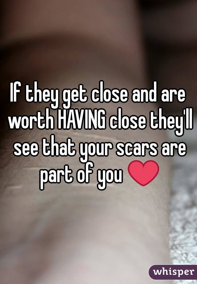If they get close and are worth HAVING close they'll see that your scars are part of you ❤