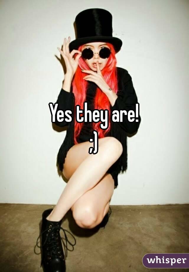 Yes they are!
;)