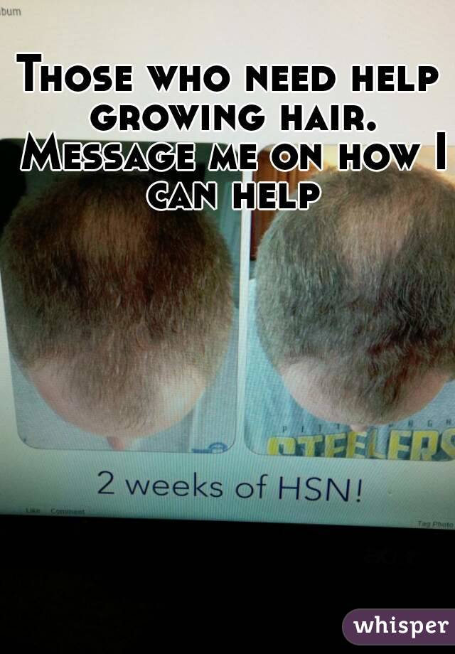 
Those who need help growing hair. Message me on how I can help

