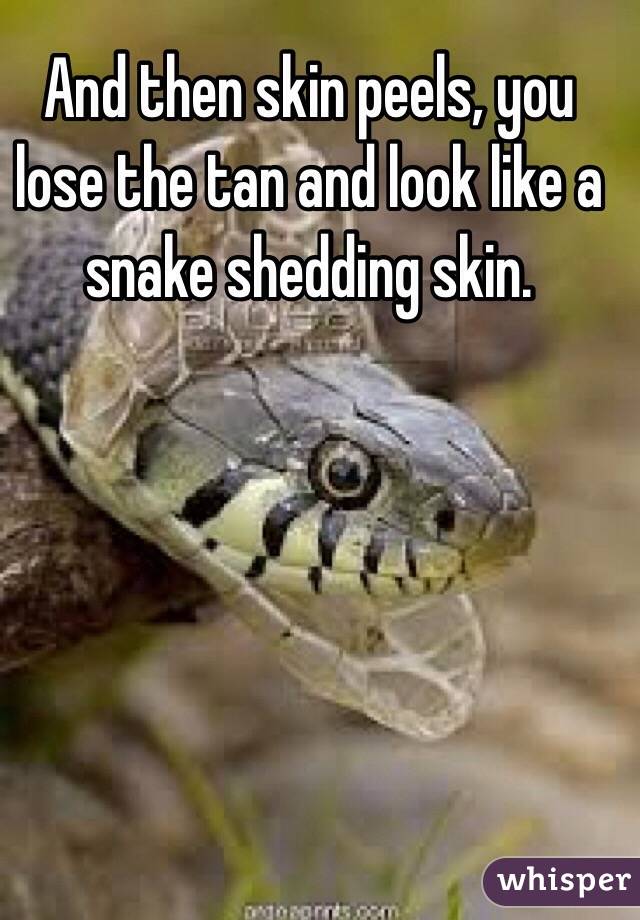 And then skin peels, you lose the tan and look like a snake shedding skin. 