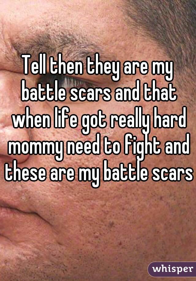 Tell then they are my battle scars and that when life got really hard mommy need to fight and these are my battle scars 