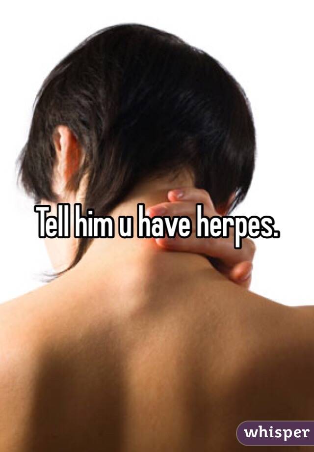 Tell him u have herpes. 