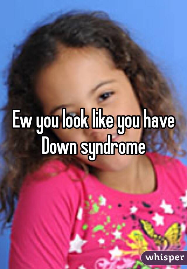 Ew you look like you have Down syndrome