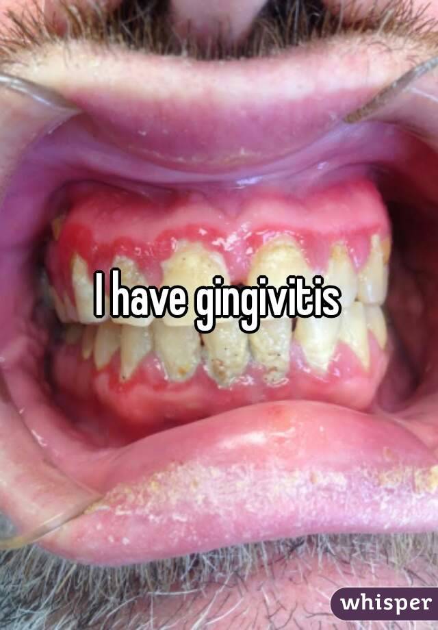 I have gingivitis