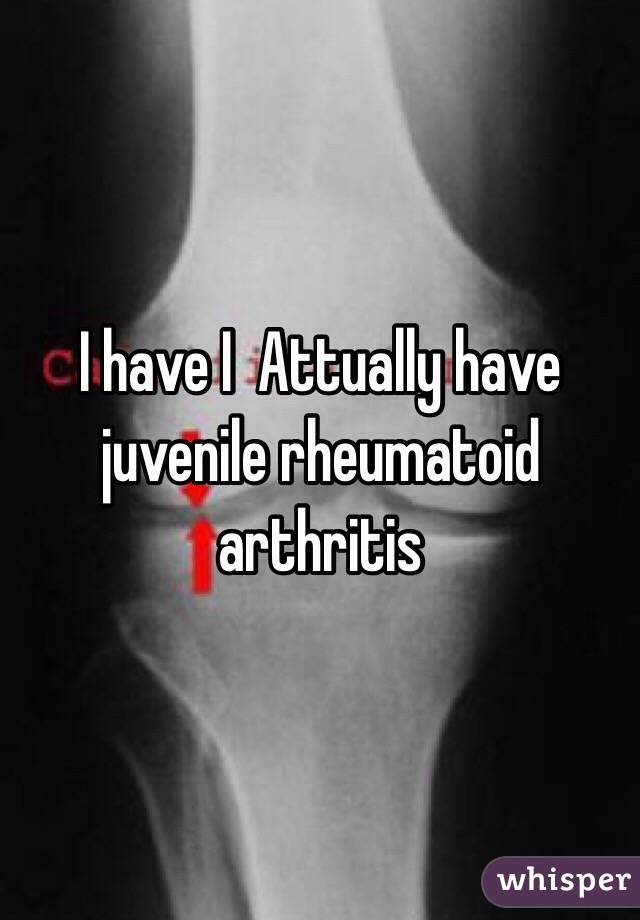 I have I  Attually have juvenile rheumatoid arthritis 