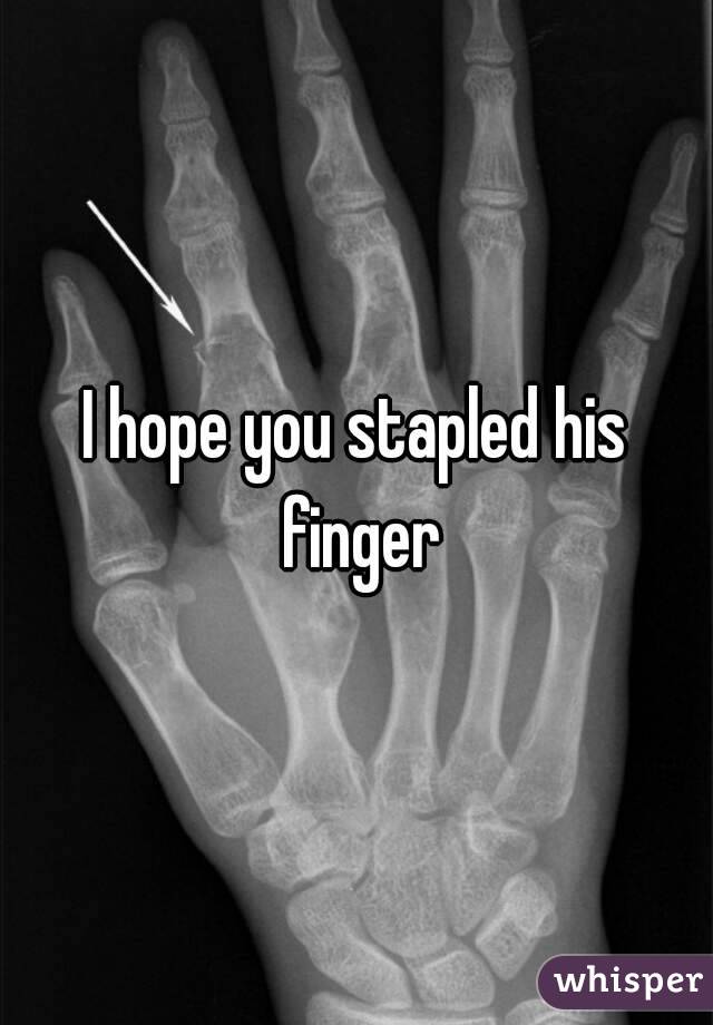 I hope you stapled his finger