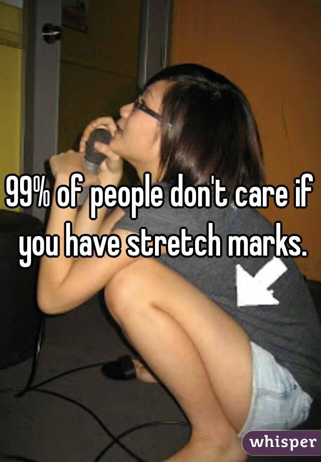 99% of people don't care if you have stretch marks.