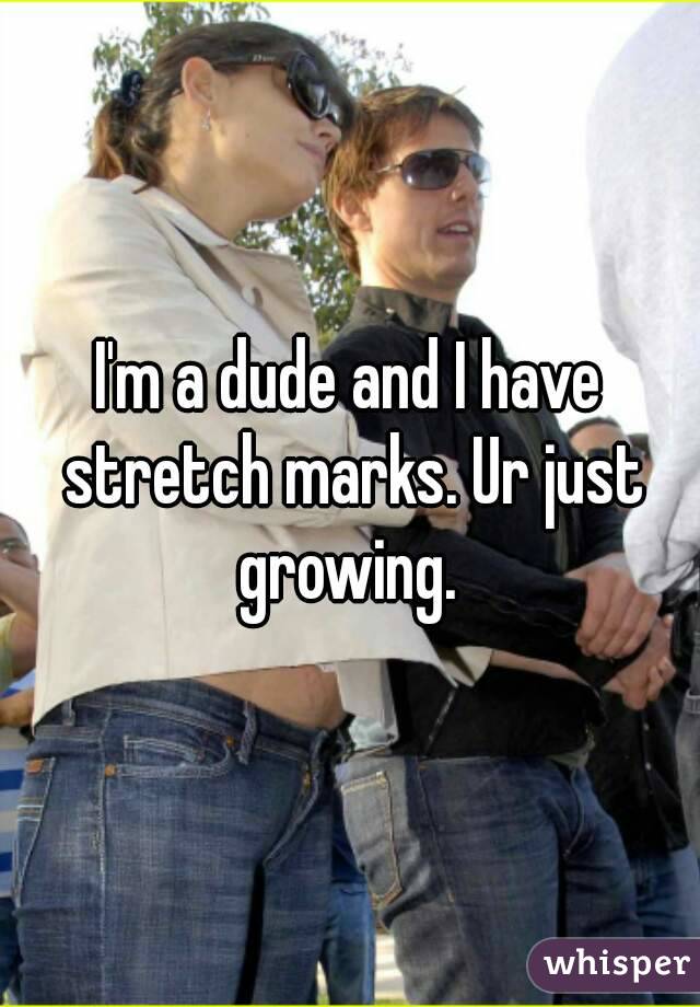 I'm a dude and I have stretch marks. Ur just growing. 