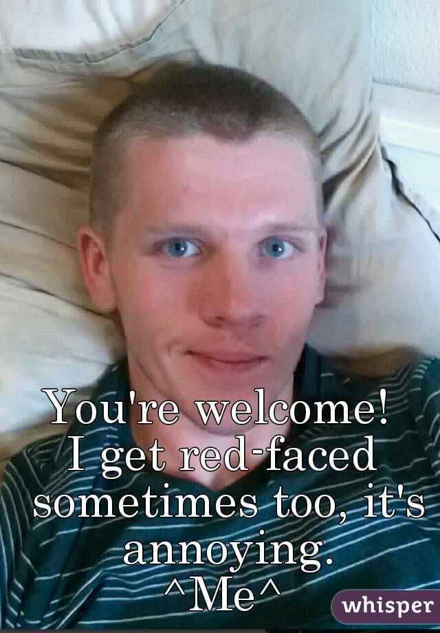 You're welcome! 
I get red-faced sometimes too, it's annoying.
^Me^
