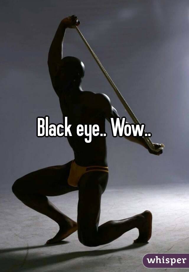 Black eye.. Wow..