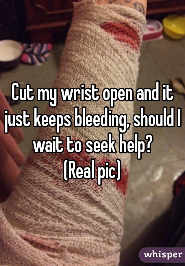 Cut my wrist open and it just keeps bleeding, should I wait to seek help? 
(Real pic) 