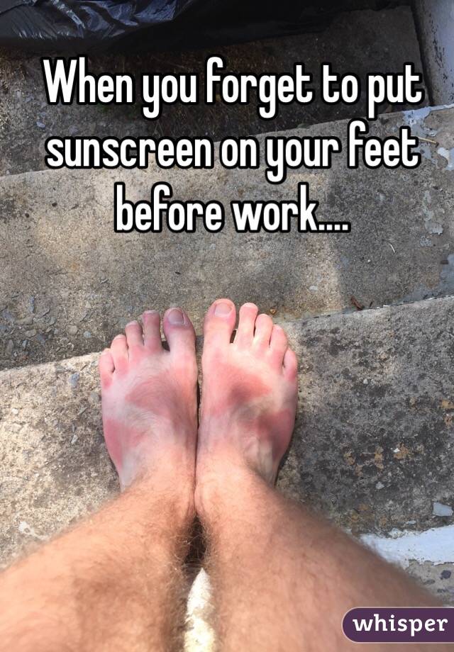 When you forget to put sunscreen on your feet before work....