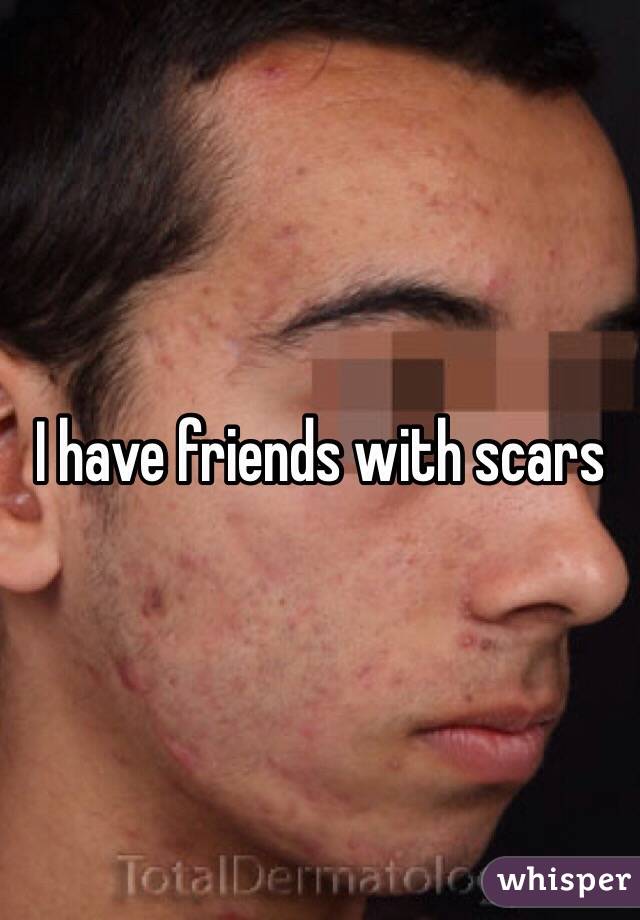 I have friends with scars