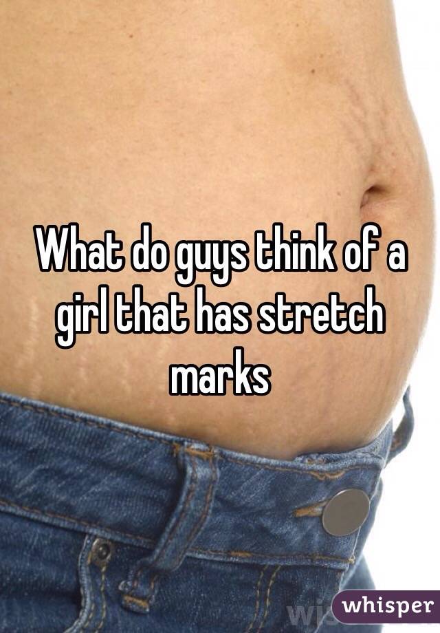 What do guys think of a girl that has stretch marks 