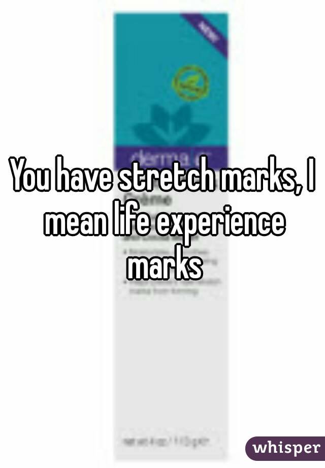 You have stretch marks, I mean life experience marks