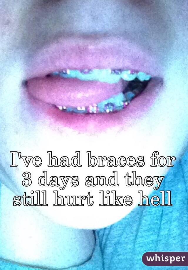 I've had braces for 3 days and they still hurt like hell 
