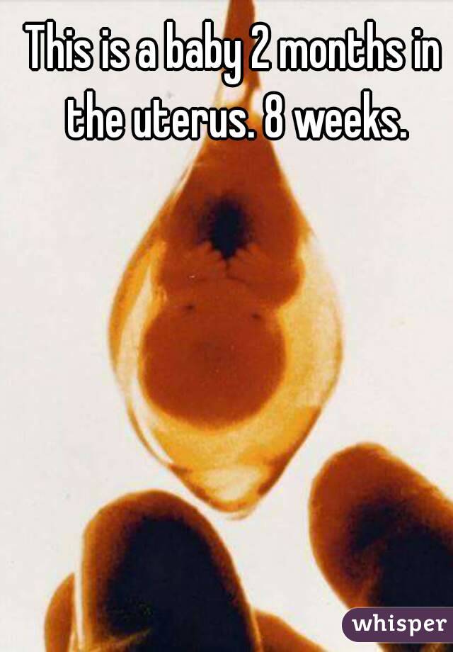 This is a baby 2 months in the uterus. 8 weeks.
