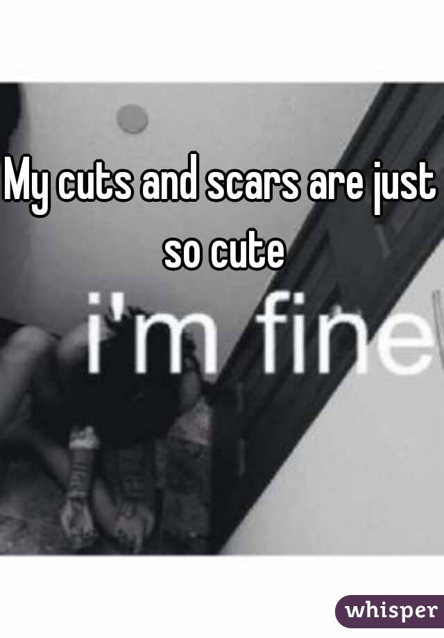 My cuts and scars are just so cute