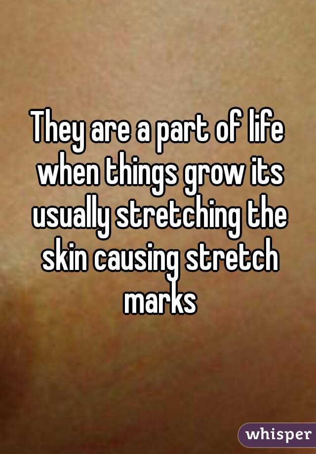 They are a part of life when things grow its usually stretching the skin causing stretch marks